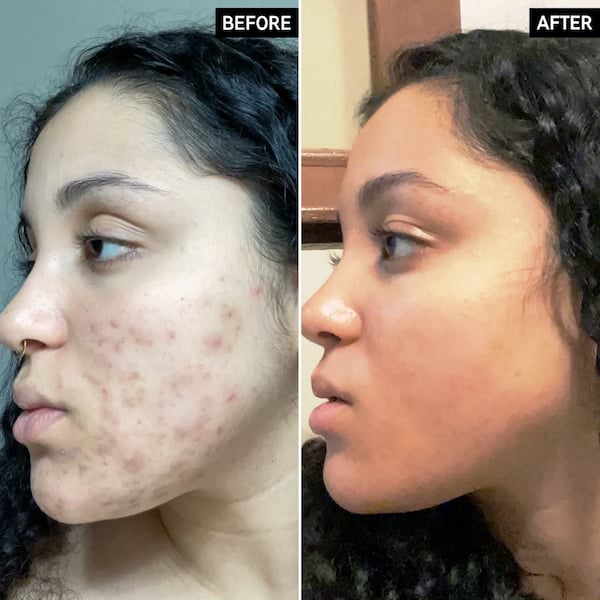 The Inkey List 30% Vitamin C Serum, 30 ml 2 The Inkey List 30% Vitamin C Serum, 30 ml - Image 2