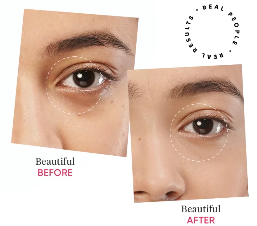 Dot & Key Pomegranate Retinol And Caffeine Eye Cream, 20 ml 2 Dot & Key Pomegranate Retinol And Caffeine Eye Cream, 20 ml