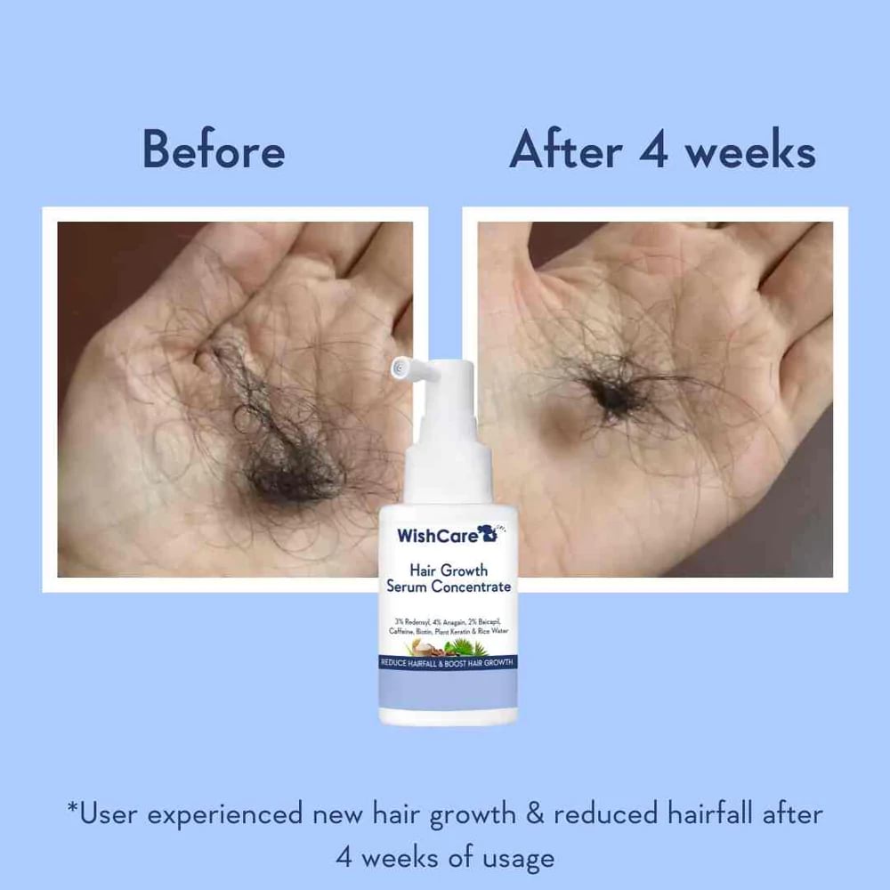 WishCare Hair Growth Serum Concentrate, 30 ml 2 WishCare Hair Growth Serum Concentrate, 30 ml