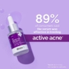 The Derma Co. 2% Salicylic Acid Serum For Active Acne, 30 ml