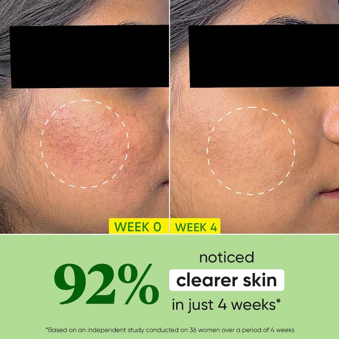 Dot & Key Cica Niacinamide Oil Free Moisturizer MINI For Acne Prone Skin, 15 ml 3 Dot & Key Cica Niacinamide Oil Free Moisturizer, 60 ml