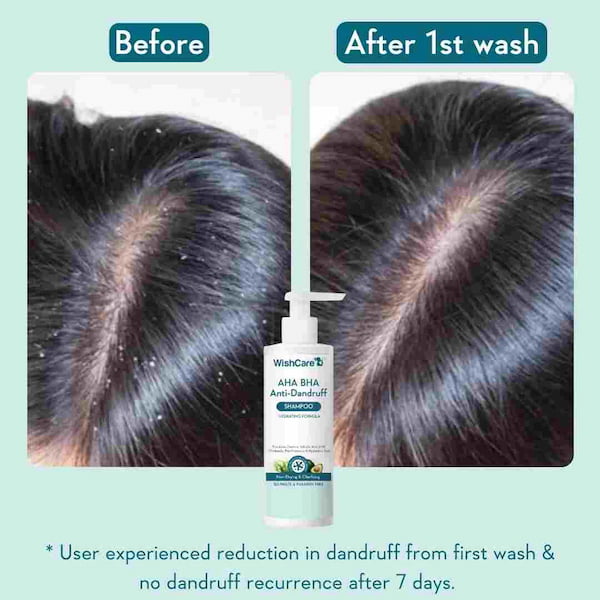 Wishcare AHA BHA Anti Dandruff Shampoo, 250 ml 2 Wishcare AHA BHA Anti Dandruff Shampoo, 250 ml - Image 2